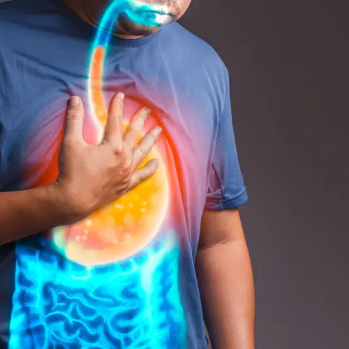 cirugía anti reflujo playa del carmen