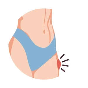 Cirugía de Hernias en Playa del Carmen