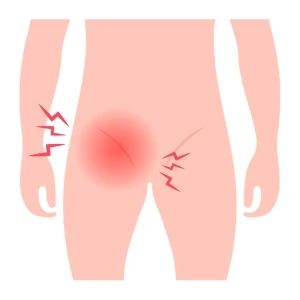 Cirugía de Hernias en Playa del Carmen