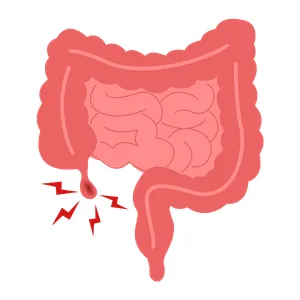 Inicio Cirugía General en Playa del Carmen