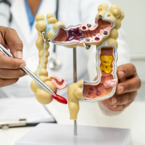 Cirugía General en Playa del Carmen