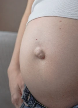 Cirugía de Hernia Umbilical en Playa del Carmen