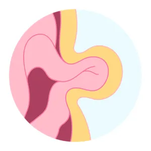 Inicio Cirugía General en Playa del Carmen