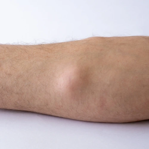 Cirugía General en Playa del Carmen