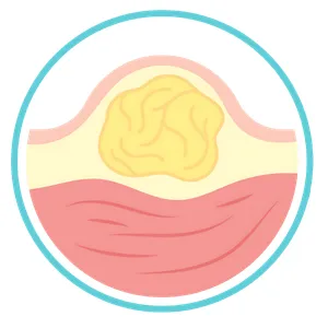 Inicio Cirugía General en Playa del Carmen